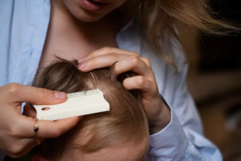 Why do babies lose their hair